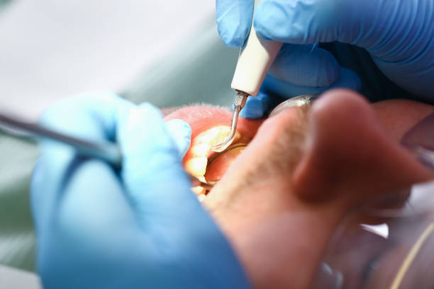 Best Emergency Treatment for Oral Infections in New London, IA