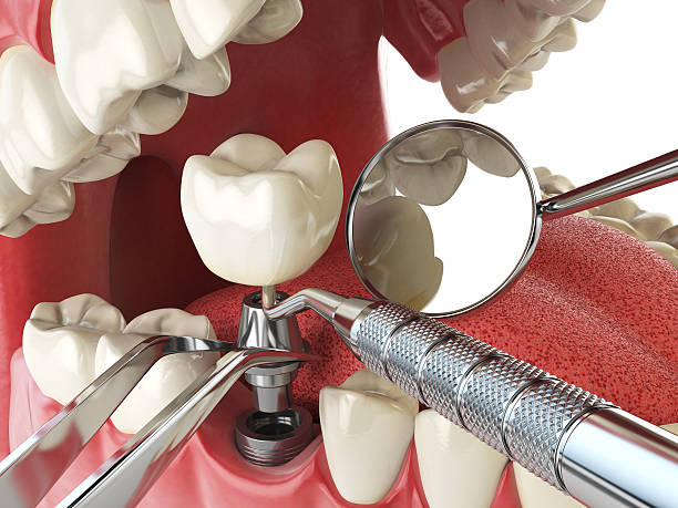 Best Emergency Treatment for Jaw Pain or Injury in New London, IA